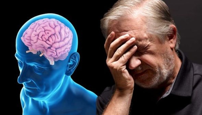 Bệnh Alzheimer là gì? Nguyên nhân và cách điều trị